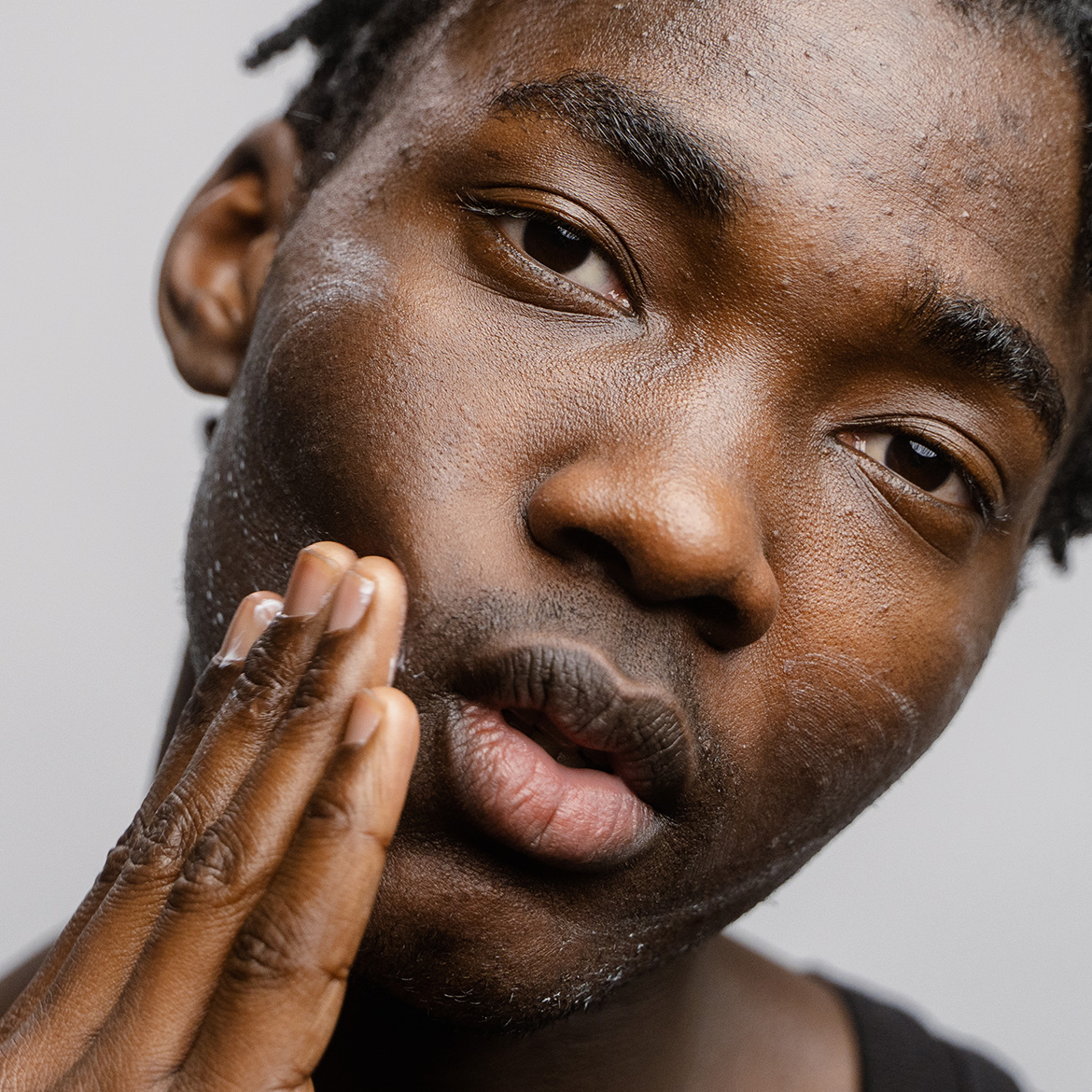 The World's biggest study on sensitive skin.Ever.